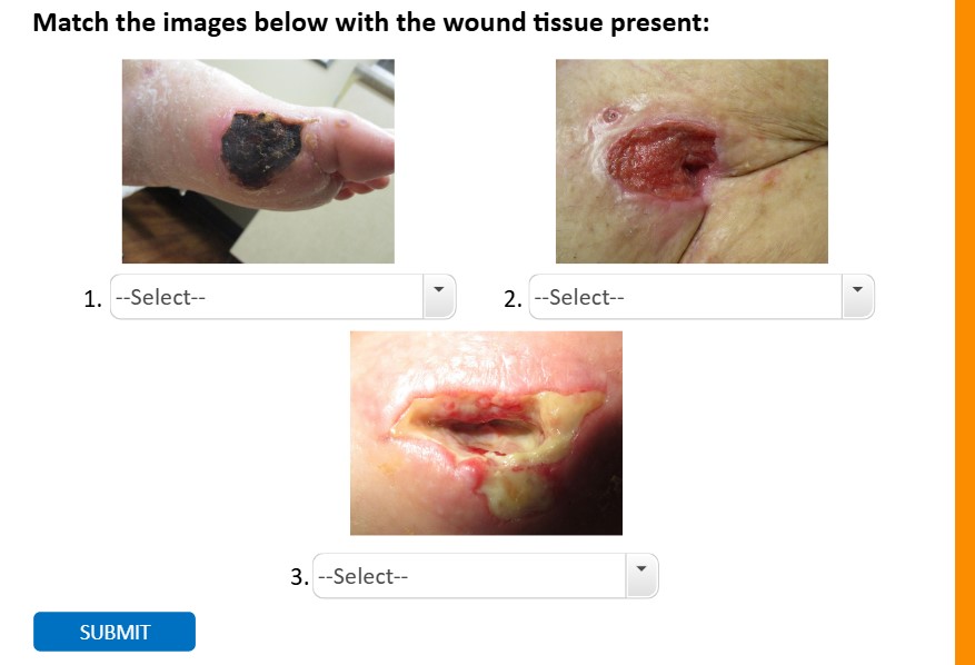 SIMS Wound Care Simulations 2