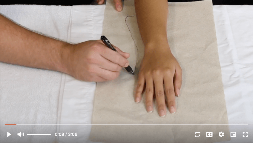 Splinting Dorsal blocking orthosis