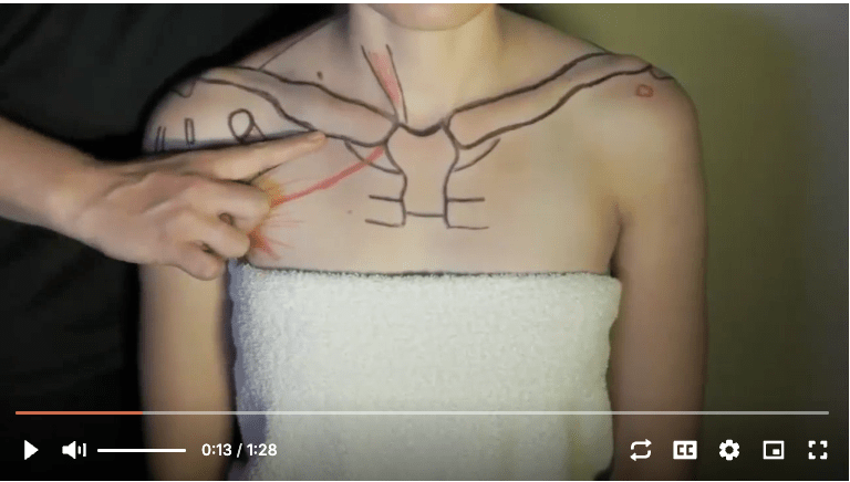 Surface Anatomy Palpation Shoulder Soft Tissue Anterior