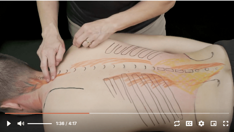 Surface Anatomy Palpation Thoracic Soft Tissue