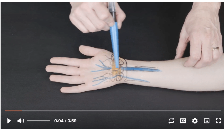 Surface Anatomy Palpation Wrist Hand Nerve Entrapment-Anterior